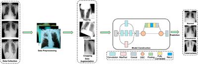 DSEception: a noval neural networks architecture for enhancing pneumonia and tuberculosis diagnosis